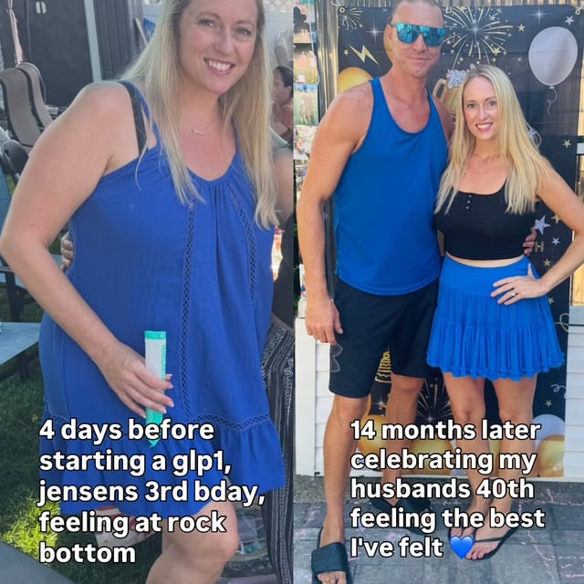 How I Finally Quieted the Food Noise: My Glp-1 Weight Loss Story